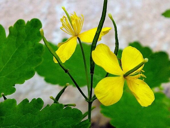 Celandine do leczenia łuszczycy
