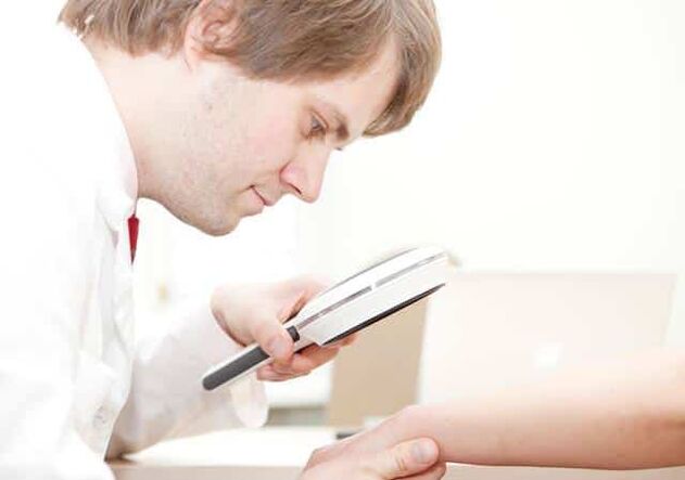 Rozpoznanie łuszczycy przez dermatologa